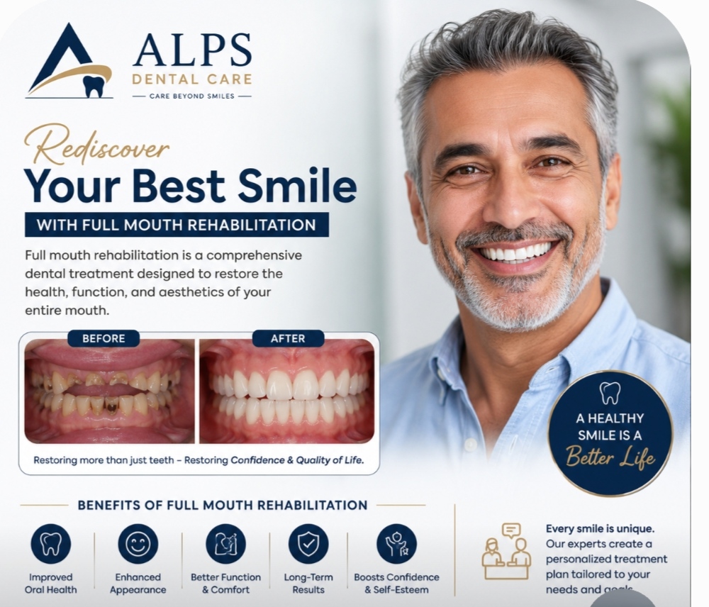 Full mouth rehabilitation 