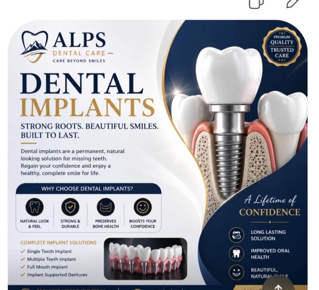 Dental implants 