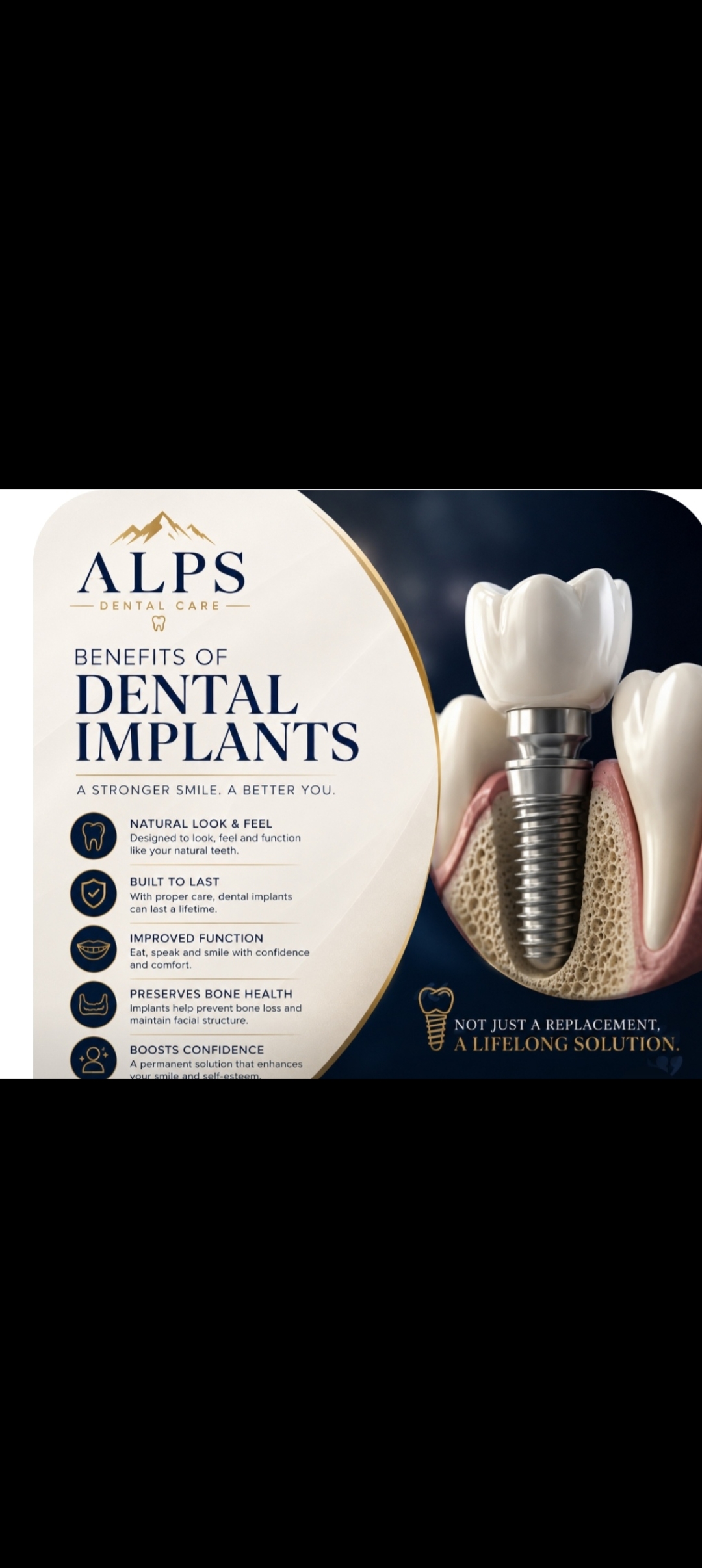 Dental Implants 
