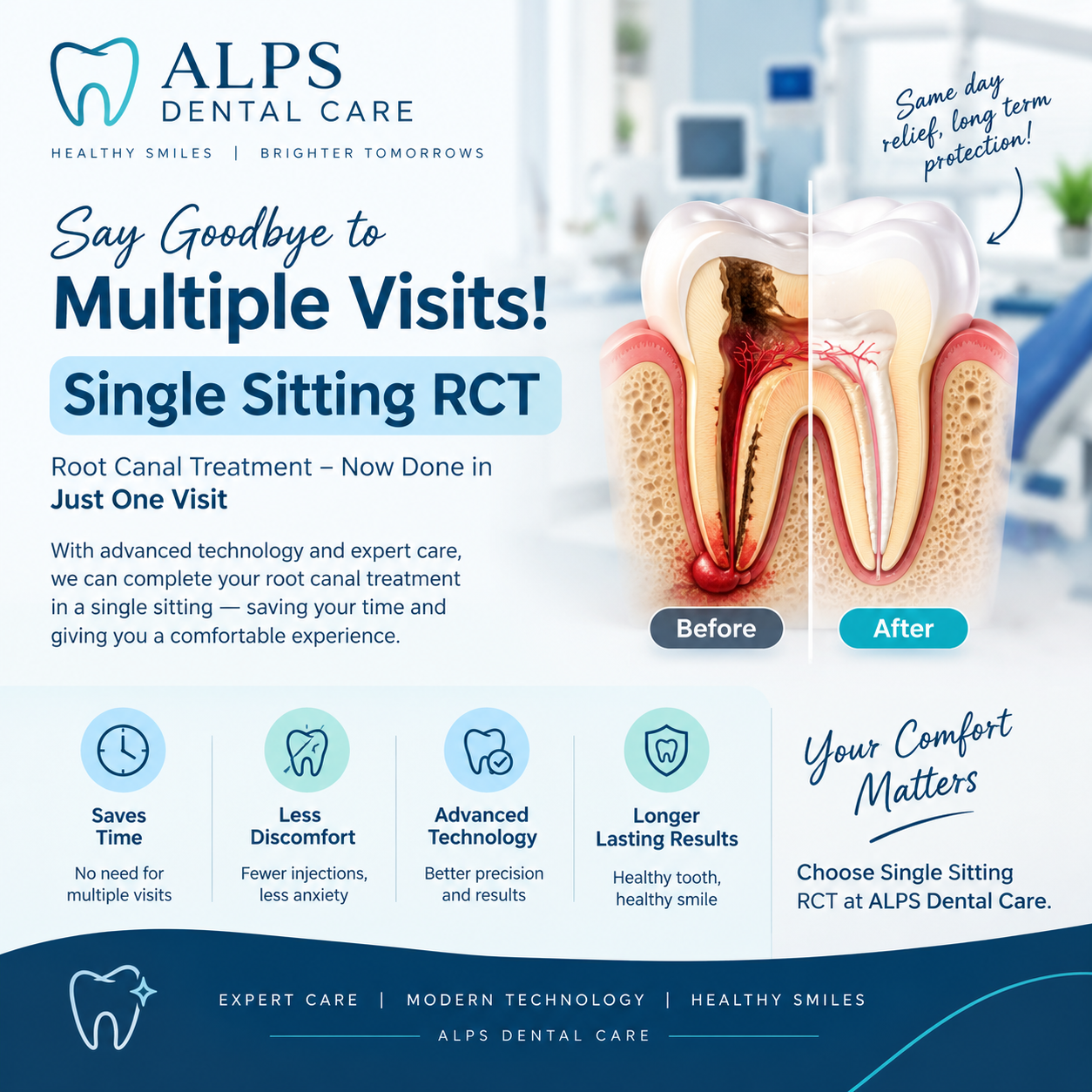 Single sitting RCT 